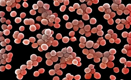 Image: Colored scanning electron micrograph (SEM) of Methicillin-resistant Staphylococcus aureus (MRSA) bacterium (Photo courtesy of AMI Images).